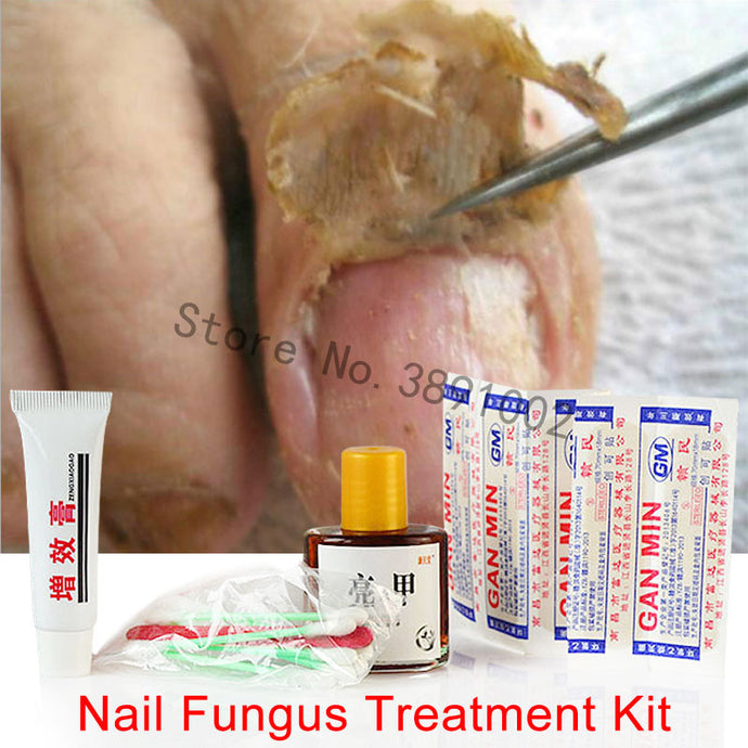 Essential Oil/Chinese Medicine Herbs Toe Nail Fungus Treatment Anti Fungal Nail Infection Essence Nail Treatment Removal Nail Care Lotion